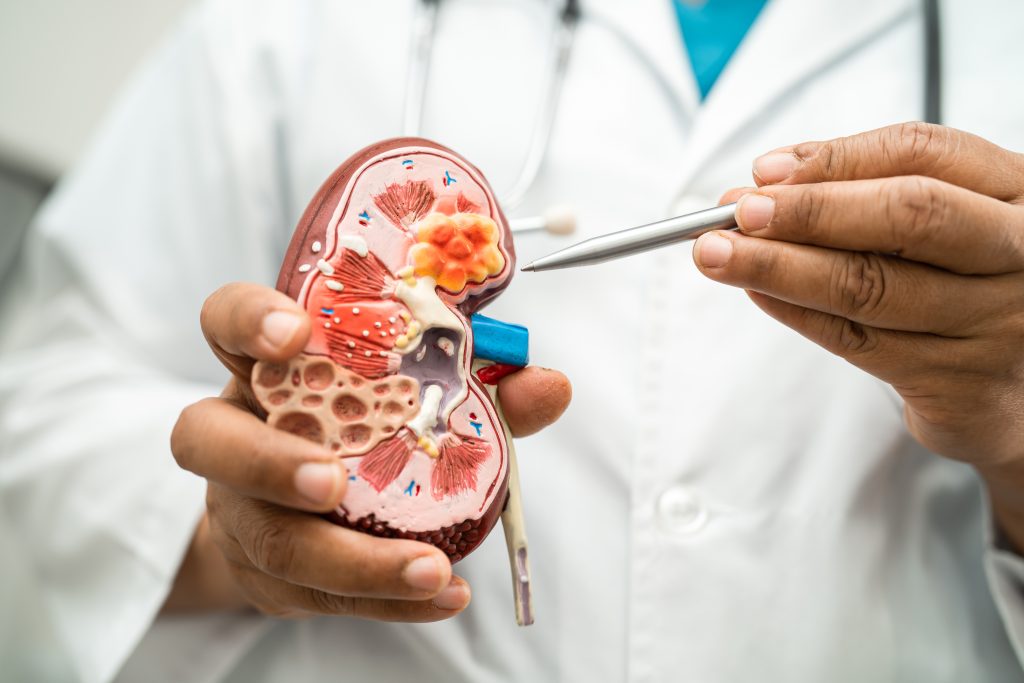 Nephrology & Transplant
